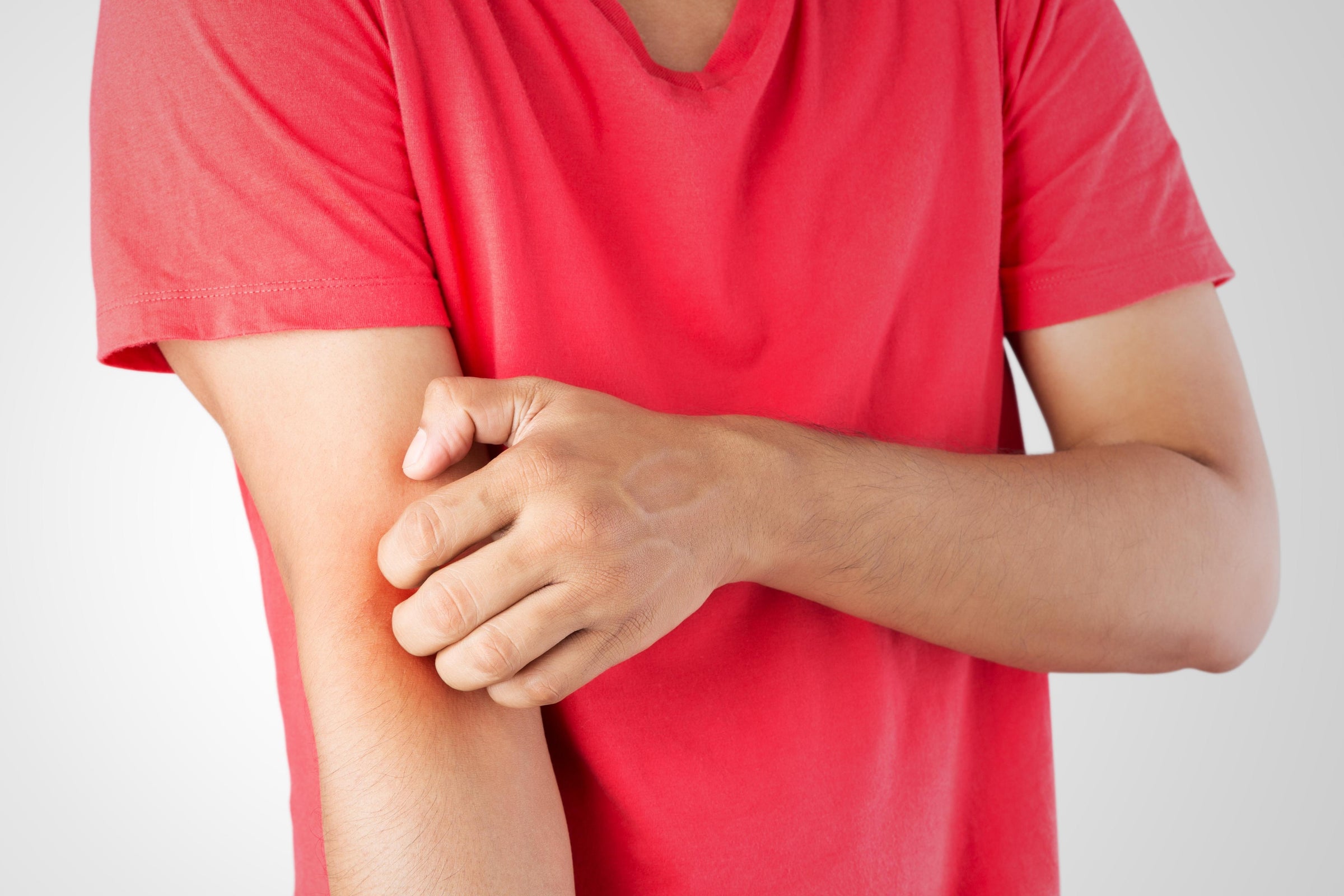 Man wondering, “Why do healing wounds itch?” while scratching his arm