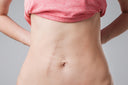 Woman wondering, "How long does it take for surgery incisions to heal?"